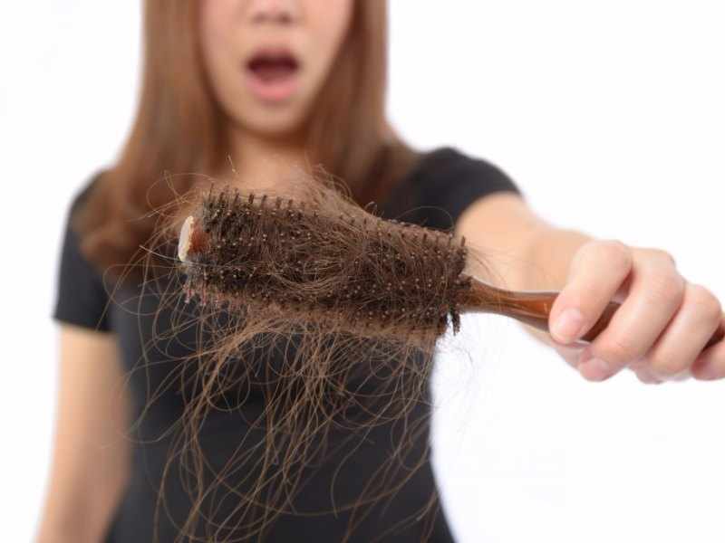 alopecia telogena mejores especialistas toluca